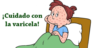 Aviso de epidemia de varicela